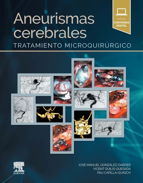 González Darder. José Manuel. Aneurismas Cerebrales Tratamiento Microquirúrgico. 1a ed. 2022