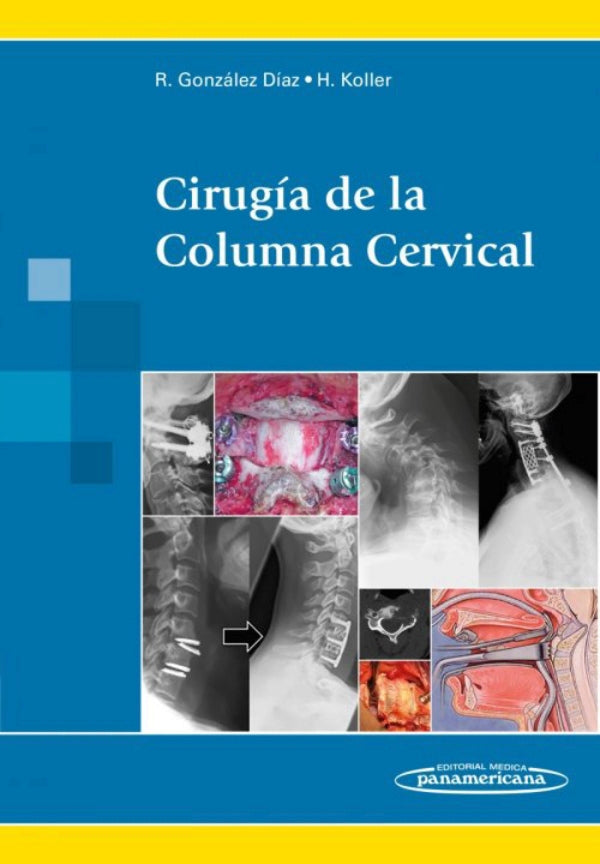 González Díaz. Rafael  Cirugía de la Columna Cervical1a ed. 2015