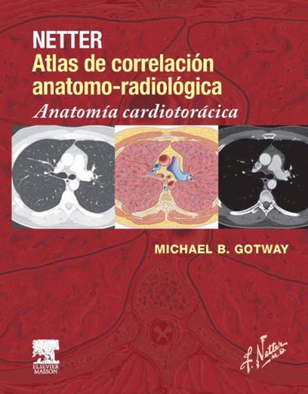 Gotway, M.B., Netter. Atlas de correlación anatomo-radiológica: Anatomía cardiotorácica © 2014