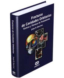 Jorge Orlando Güerrissi. Fracturas de Cavidades Orbitarias. 1a. ed. 2006