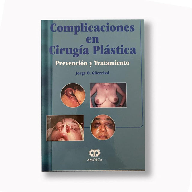 Jorge Orlando Güerrissi. Complicaciones en Cirugía Plástica Prevención y Tratamiento. 1a. ed. 2002