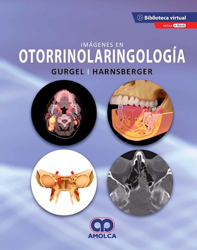 Richard K. Gurgel. Imágenes en Otorrinolaringología. E-Book.