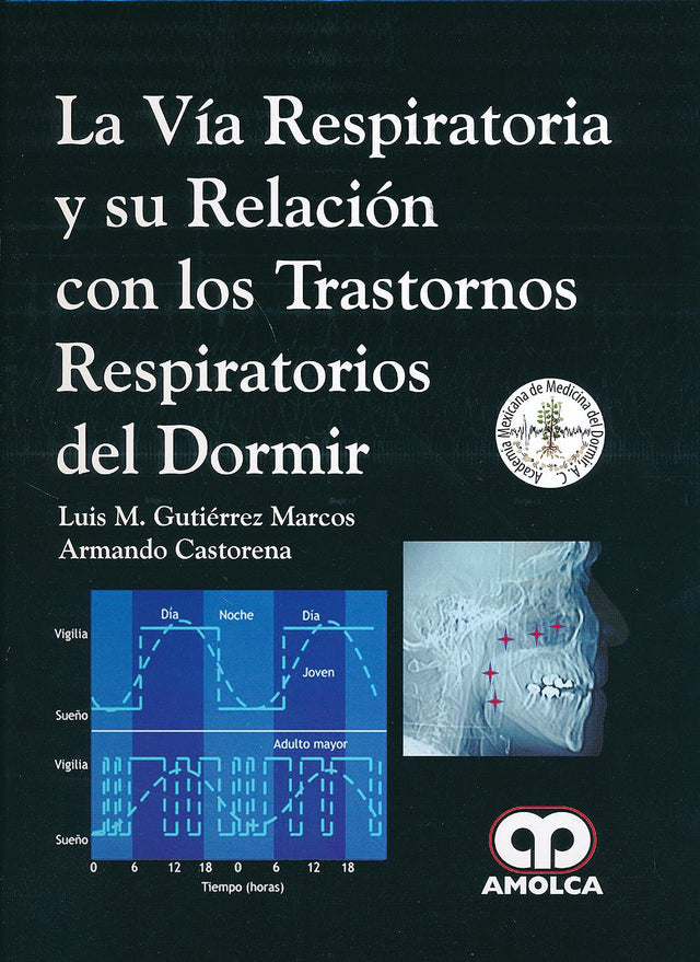 Luis M. Gutiérrez Marcos. La vía Respiratoria y su Relación con los Trastornos Respiratorios del Dormir. 1a. ed. 2014