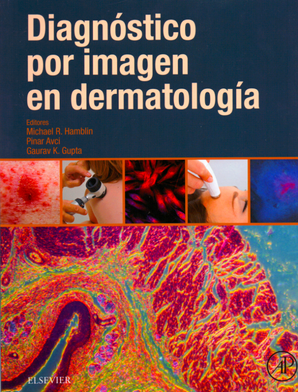 Hamblin, M. R., Diagnóstico por imagen en dermatología © 2017