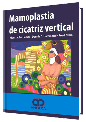 Moustapha Hamdi. Mamoplastía de Cicatriz Vertical. 1a. ed. 2007