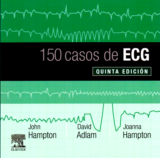 Hampton, J.R., 150 casos de ECG 5 ed. © 2019