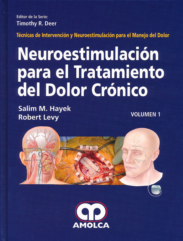 Salim M. Hayek. Neuroestimulación para el Tratamiento del Dolor Crónico V-1. 1a. ed. 2013