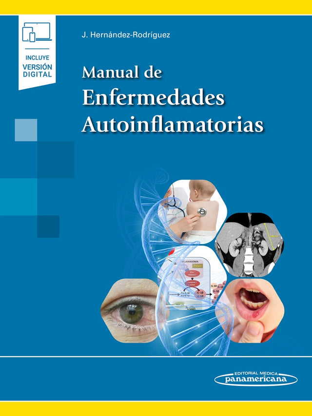 Hernández Rodríguez. José. Manual de Enfermedades Autoinflamatorias. 1a ed. 2022