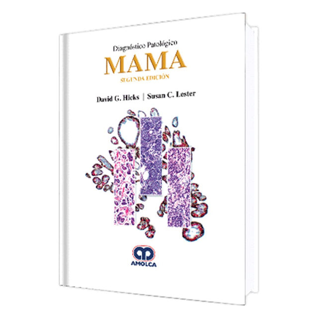 David G. Hicks. Diagnóstico Patológico Mama. 2a. ed. 2018