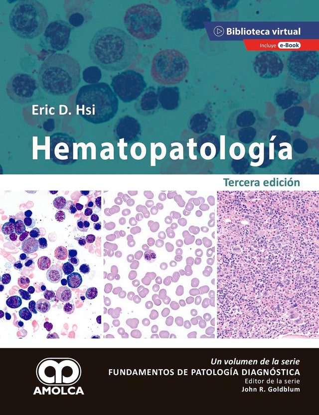 Eric D. Hsi. Hematopatología. 3ª Edición. E-Book. 3a. ed. 2020
