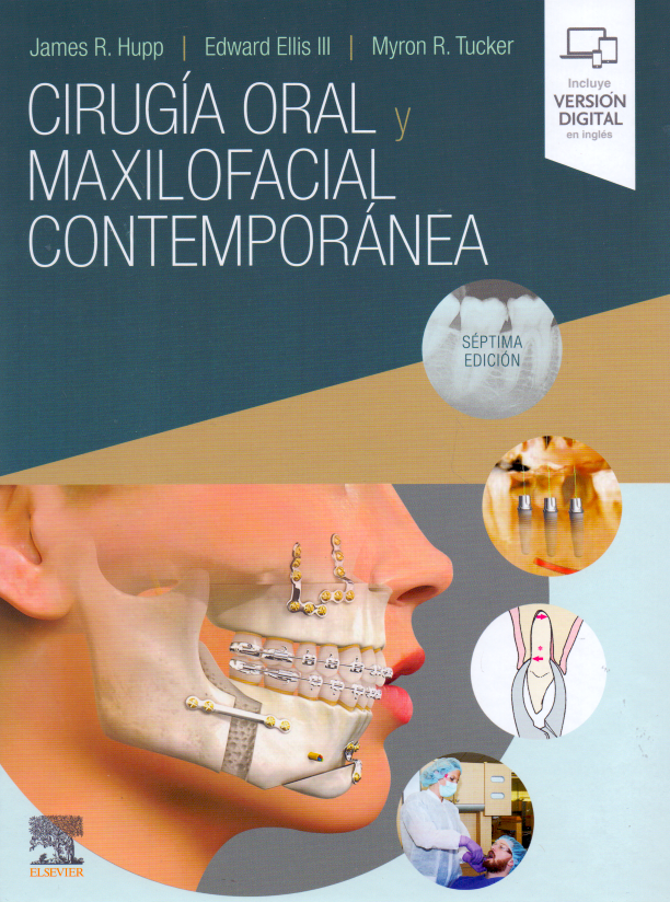 Hupp, J.R., Cirugía oral y maxilofacial contemporánea 7 ed. © 2020