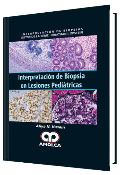 Aliya N. Husain. Interpretación de Biopsia en Lesiones Pediátricas. 1a. ed. 2016