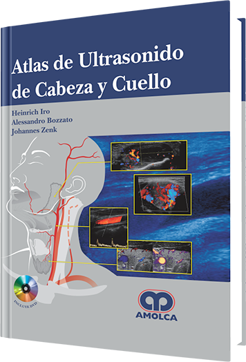 Heinrich Iro. Atlas de Ultrasonido de Cabeza y Cuello. Incluye DVD. 1a. ed. 2014