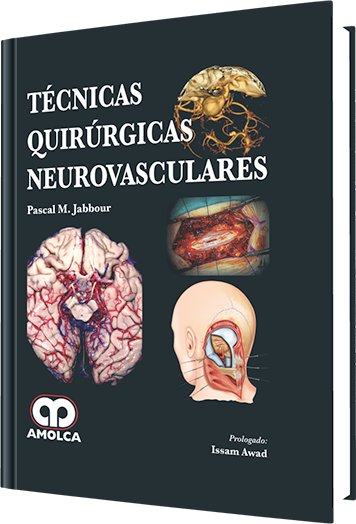 Pascal M. Jabbour. Técnicas Quirúrgicas Neurovasculares. 1a. ed. 2014