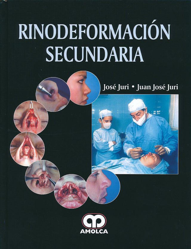 José Juri. Rinodeformación Secundaria. 1a. ed. 2013