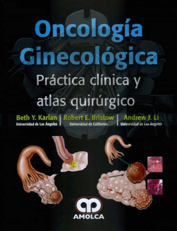 Beth Y. Karlan, MD. Oncología Ginecológica Práctica Clínica y Atlas Quirúrgico. 1a. ed. 2016