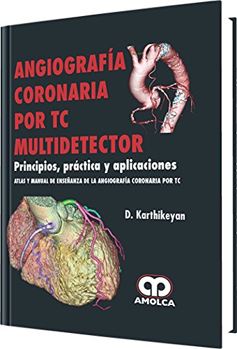 D. Karthikeyan Karthikeyan. Angiografía Coronaria por TC Multidetector. Principios, Práctica y Aplicaciones. 1a. ed. 2010
