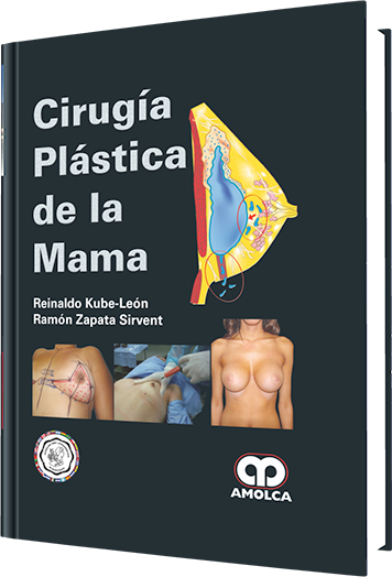 Reinaldo Kube-León. Cirugía Plástica de la Mama. 1a. ed. 2014