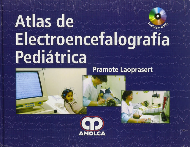Pramote Laoprasert. Atlas de Video Electroencefalografía Pediátrica. 1a. ed. 2013