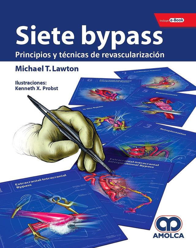 Michael T. Lawton. Siete Bypass. Principios y Técnicas de Revascularización.  Incluye e-Book. 1a. ed. 2019