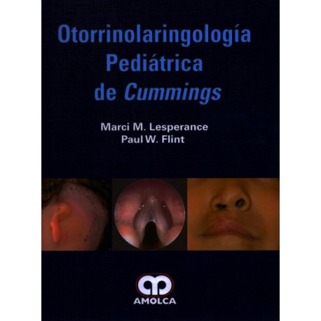 Marci M. Lesperance. Otorrinolaringología Pediátrica de Cummings. 1a. ed. 2018