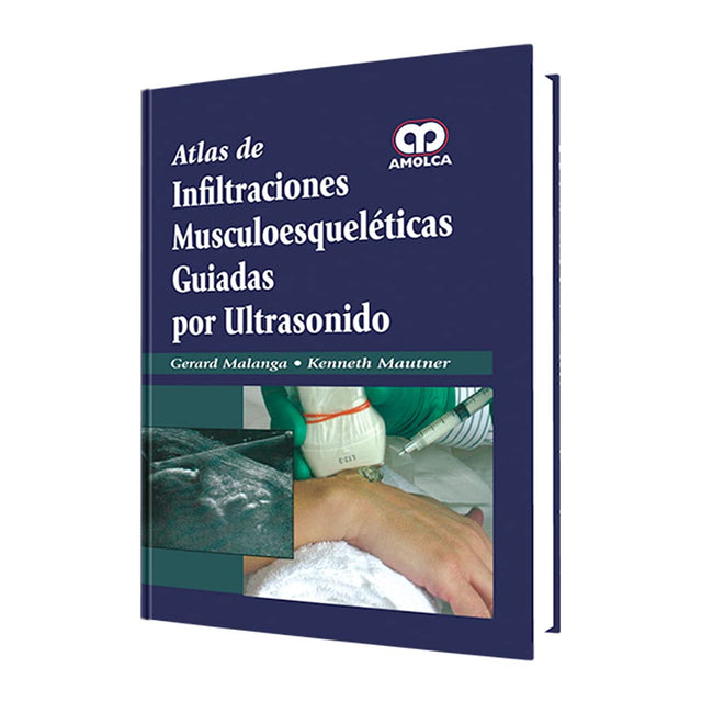 Gerard Malanga. Atlas de Infiltraciones Muscoloesqueléticas Guiadas por Ultrasonido. 1a. ed. 2015