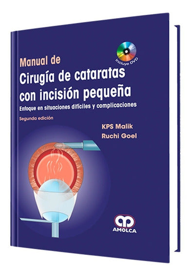 KPS Malik. Manual de Cataratas con Incisión Pequeña. Incluye DVD. 2a. ed. 2012