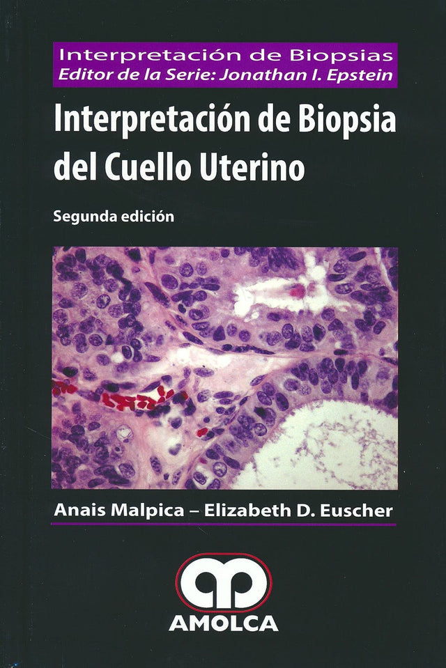 Anais Malpica. Interpretación de Biopsia del Cuello Uterino. 2a. ed. 2016