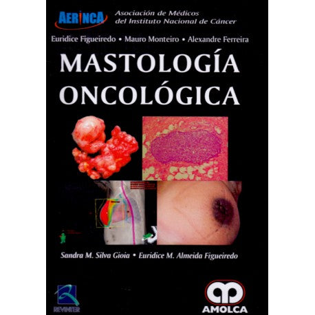 Sandra Marques Silva Gioia. Sandra Marques Silva Gioia. Mastología Oncológica. 1a. ed. 2017