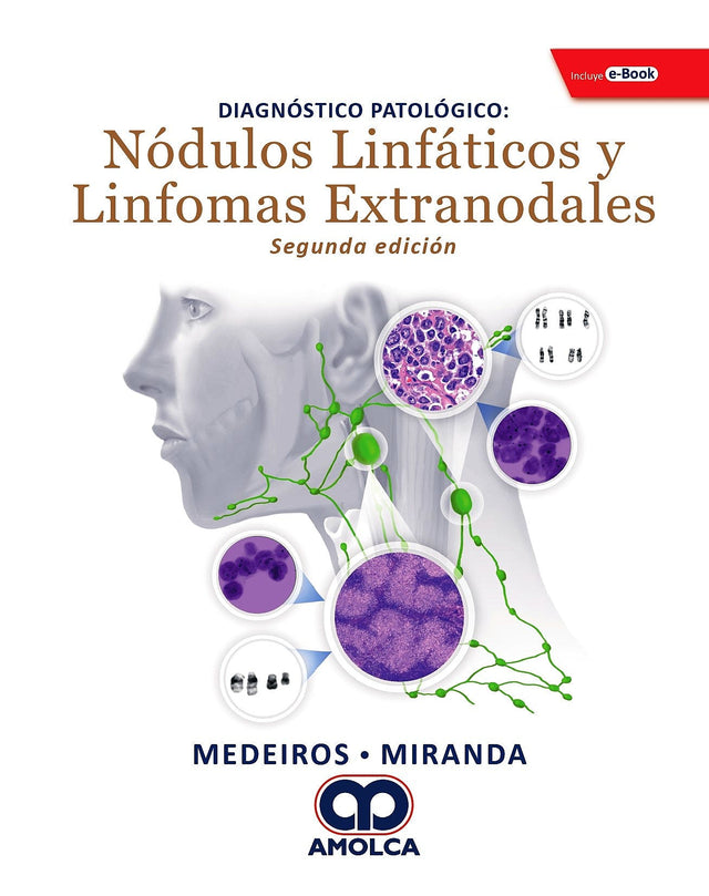 L. Jeffrey Medeiros. Diagnósticos Patológicos Nódulos Linfáticos y Linfomas Extranodales. Incluye e-Book. 2a. ed. 2019