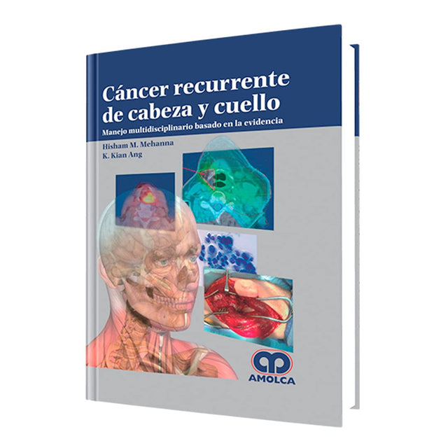 Hisham M. Mehanna. Cáncer Recurente de Cabeza y Cuello. 1a. ed. 2015