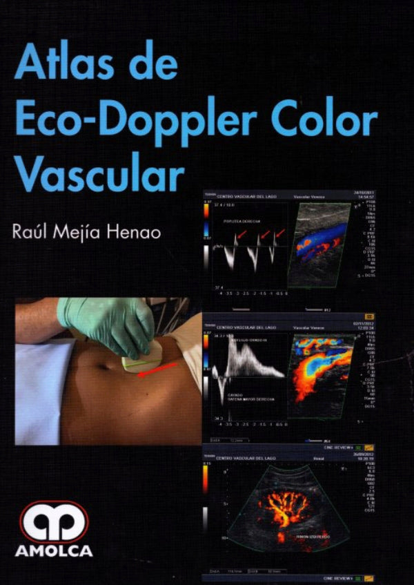 Raúl Mejia Henao. Atlas de Eco-Doppler Color Vascular. 1a. ed. 2017
