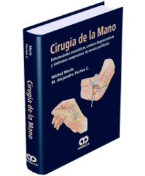Michel Merle. Cirugía de la Mano. Enfermedades Reumáticas, Crónico - Degenerativas. 1a. ed. 2013