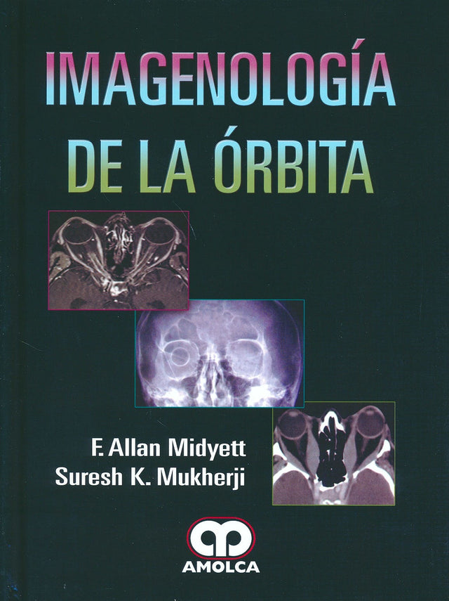F. Allan Midyett. Imagenología de la Órbita. 1a. ed. 2016