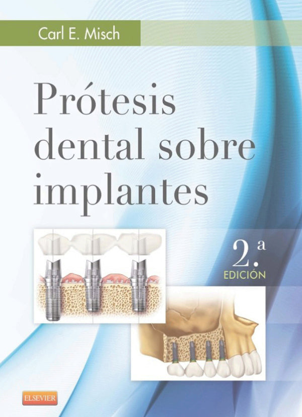 Misch E. Carl. Prótesis dental sobre implantes. 2da. ed.2015