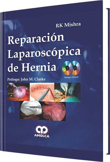 RK Mishra Mishra. Reparación Laparoscópica de Hernia. Incluye dos DVD. 1a. ed. 2014