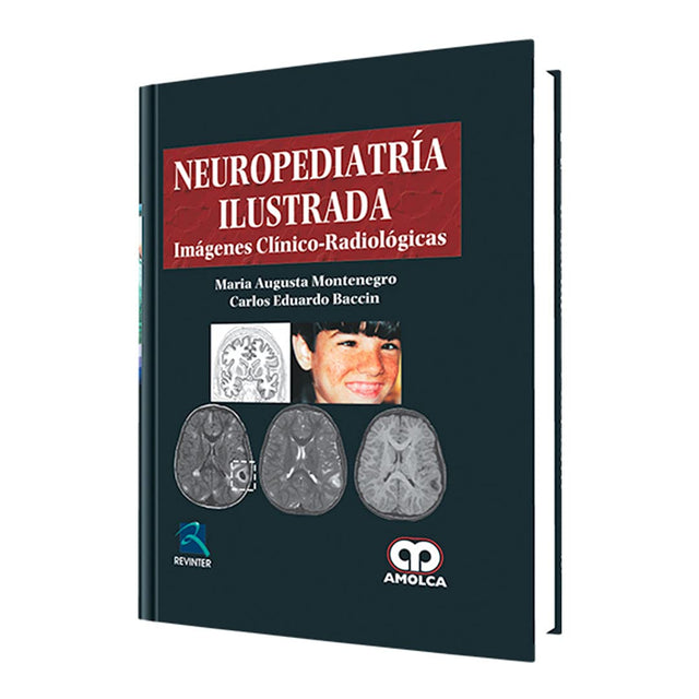 María Augusta Montenegro. Neuropediatría Ilustrada. 1a. ed. 2012