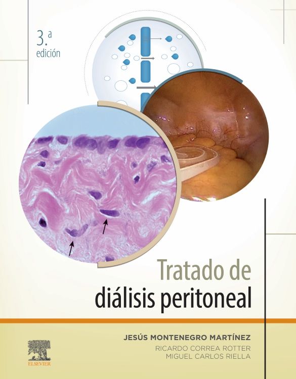 Montenegro Martínez. Jesús. Tratado de diálisis peritoneal. 3ra.  ed.2021