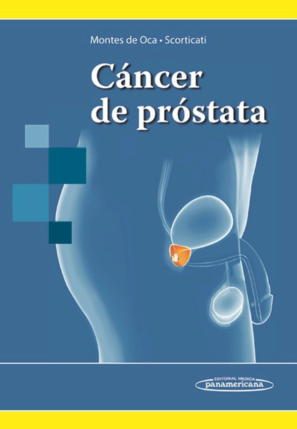 Montes de Oca. Luis Cáncer de próstata1ra ed  2014