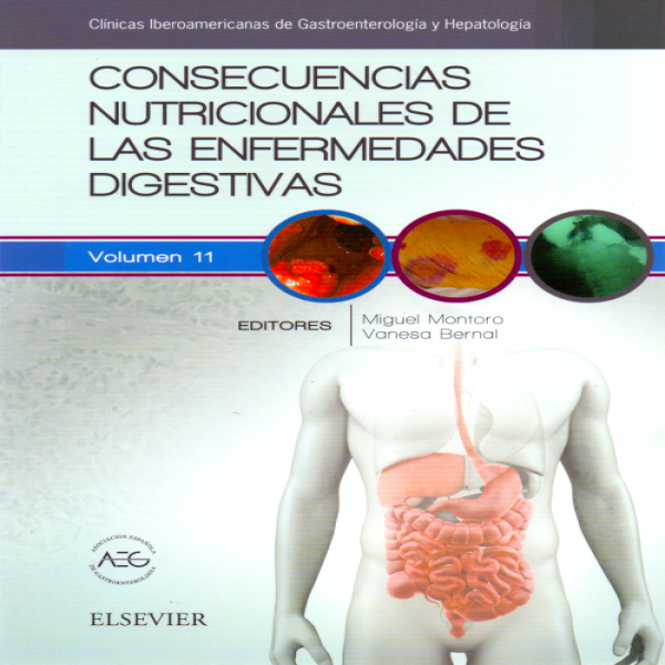 Montoro Huguet, M., Consecuencias nutricionales de las enfermedades digestivas. 1ra.   ed.2017