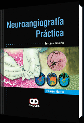 Pearse Morris. Neuroangiografía Práctica. 3a. ed. 2017