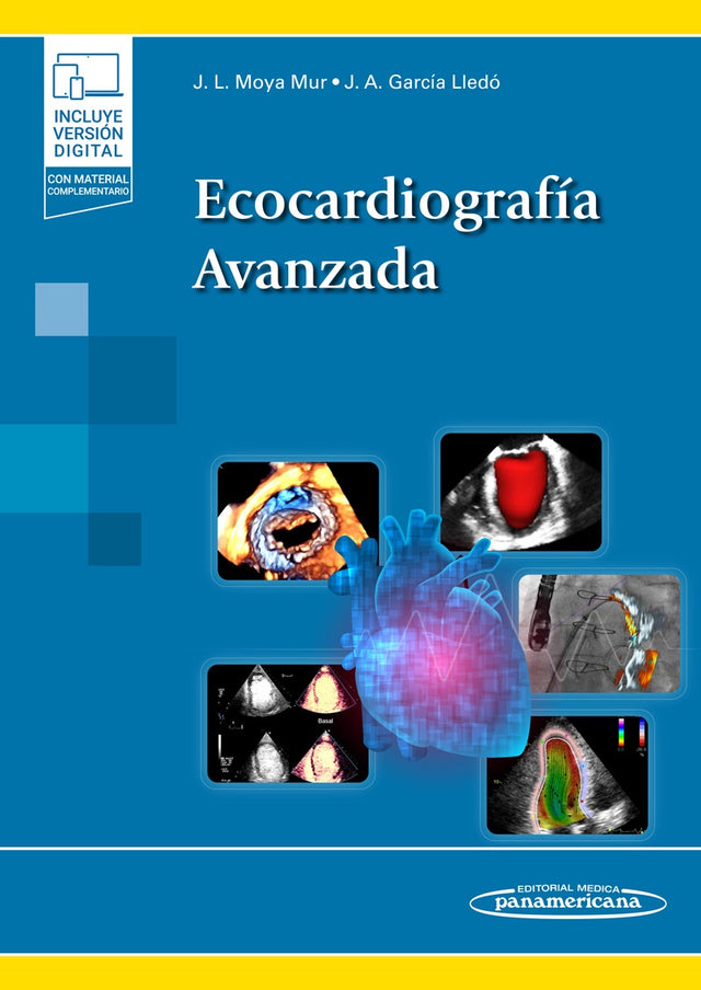 Moya Mur. José Luis. Ecocardiografía Avanzada. 1a ed. 2023
