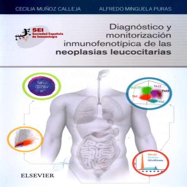 Muñoz Calleja, C., Diagnóstico y monitorización inmunofenotípica de las neoplasias leucocitarias. 1ra ed. 2019