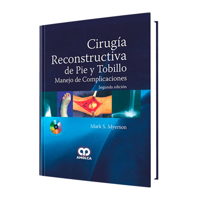 Mark S. Myerson. Cirugía Reconstructiva de Pie y Tobillo Manejo de Complicaciones. Incluye DVD  2da. ed. 2013