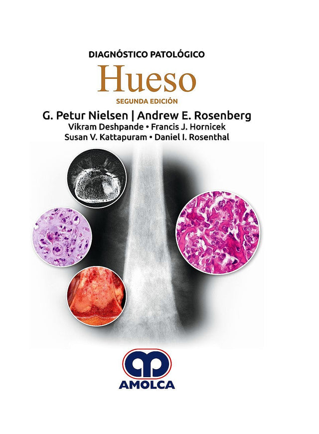 G. Petur Nielsen. Diagnóstico Patológico – Hueso. 2a. ed. 2018