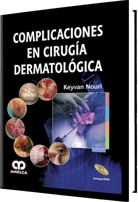 Keyvan Nouri. Complicaciones en Cirugía Dermatológica. Incluye DVD. 1a. ed. 2009