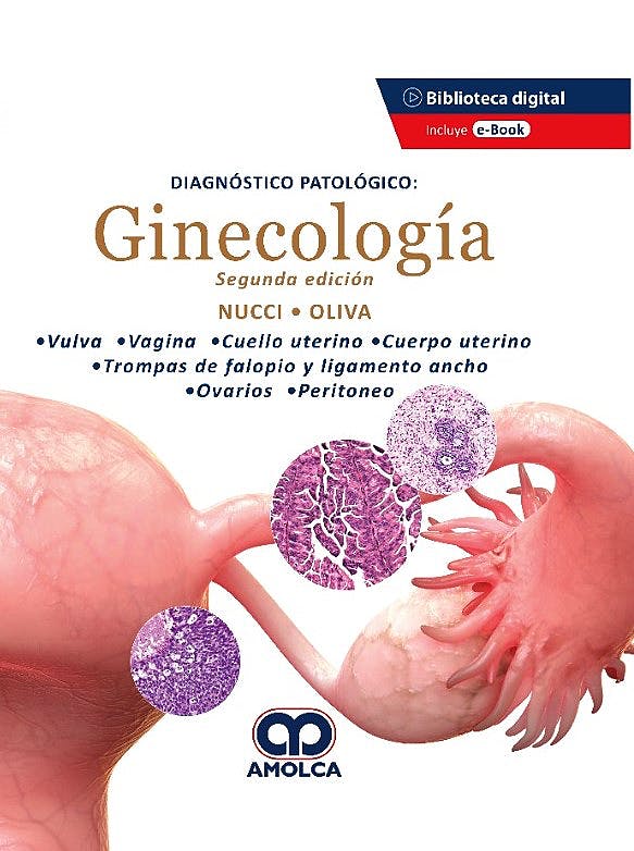 Marisa R. Nucci, MD. Diagnóstico patológico: Ginecología. 2ª ed. 2021