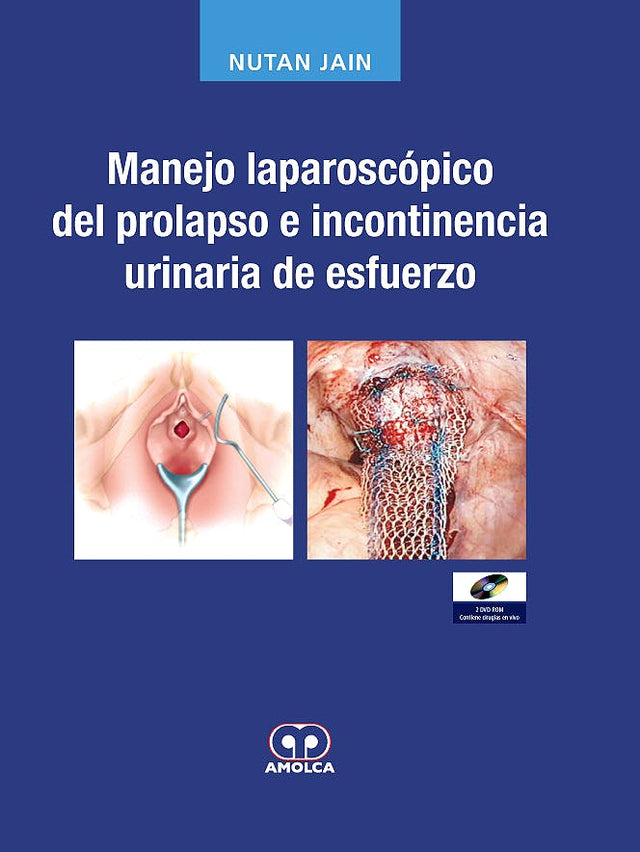 Nutan Jain. Manejo Laparascópico del Prolapso. Incluye dos DVD - ROM. 1a. ed. 2009