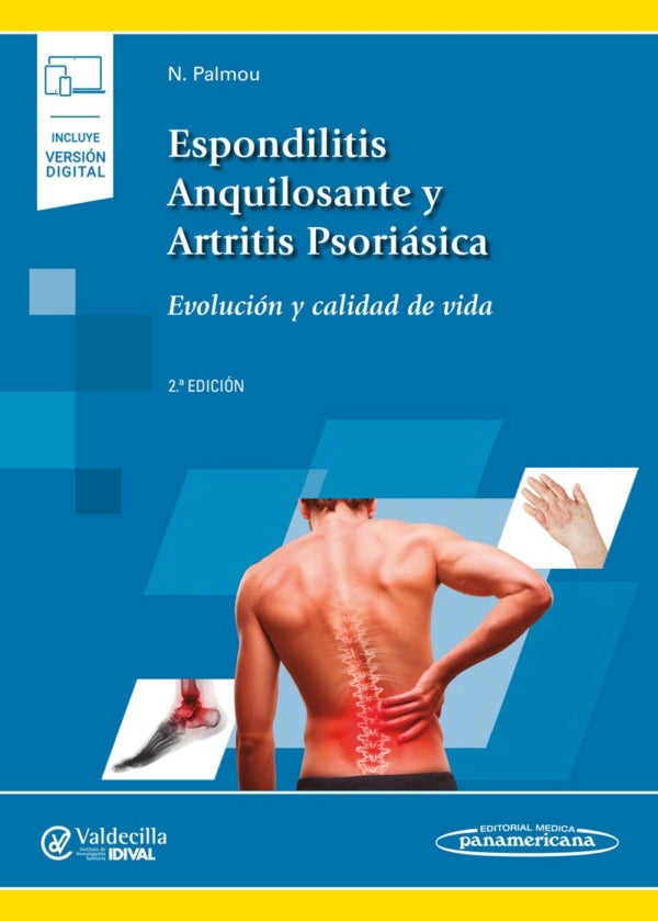 Palmou Fontana. Natalia. Espondilitis Anquilosante y Artritis Psoriásica. 2a ed. 2019
