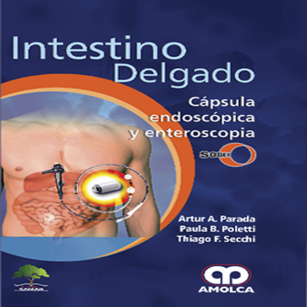 Artur A. Parada. Intestino Delgado. Cápsula Endoscópica y Enteroscopica. SOBED. 1a. 2017